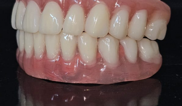 Aligners – neviditeľné strojčeky pre modernú ortodonciu Aligners – neviditeľné strojčeky pre modernú ortodonciu